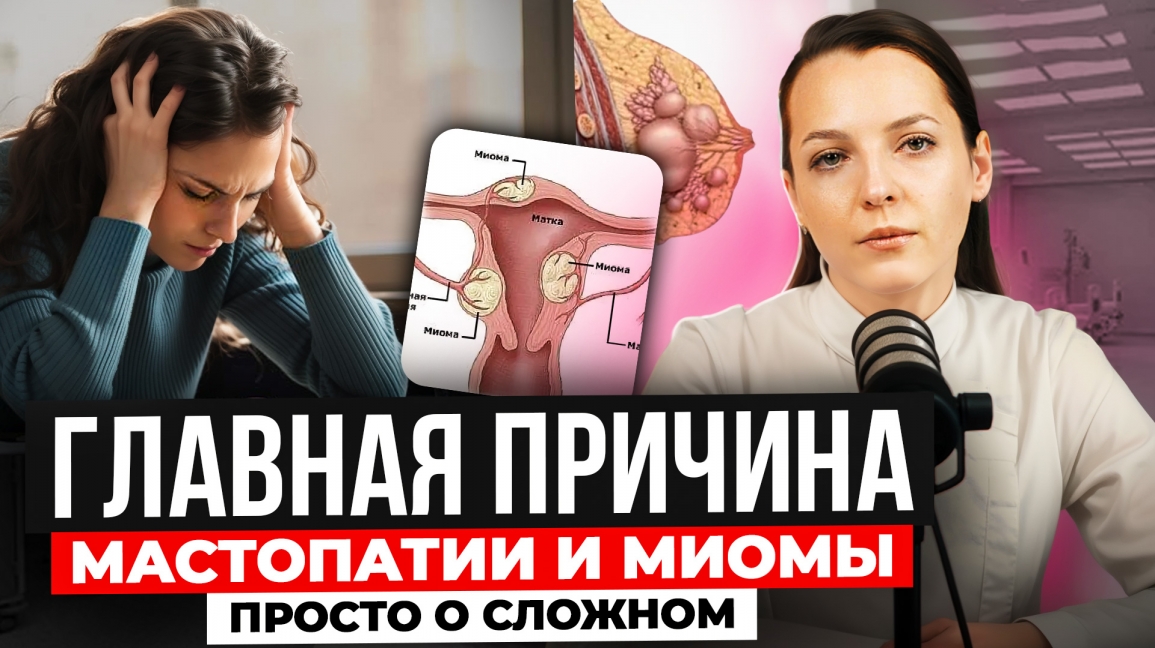 Главная причина мастопатии и миомы. Просто о сложном.